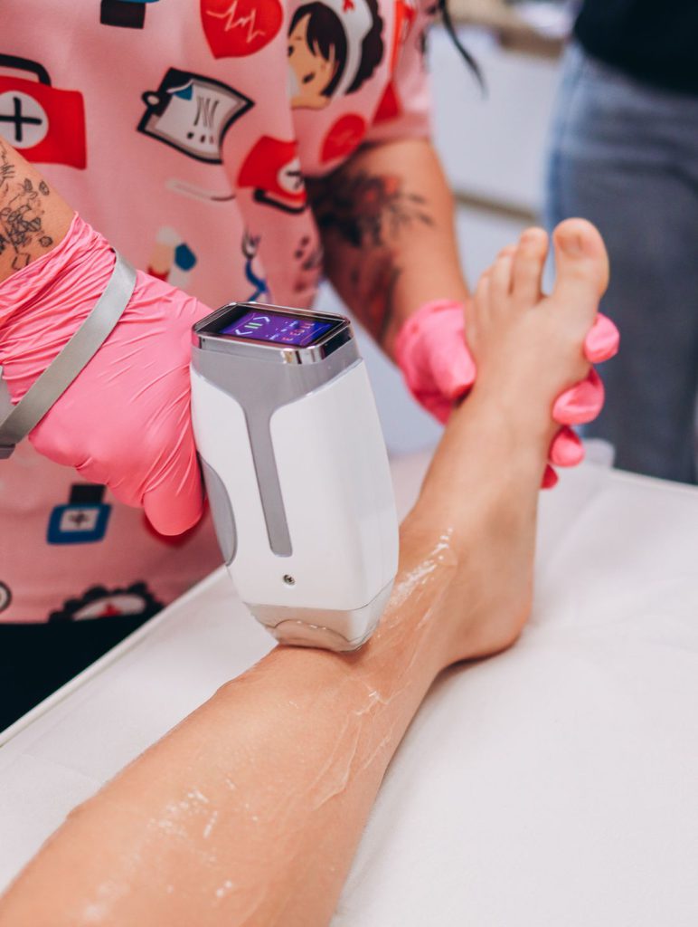 Appareil d’épilation laser au contact de la peau
